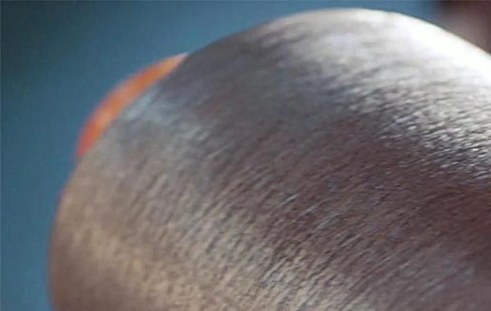 Us Company Noble Biomaterials wprowadza na rynek nowe rozwiązanie Ionic + Fabric